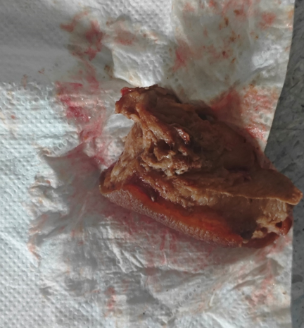 6ca6641f_4b7f_4f9b_ade1_9bcdde